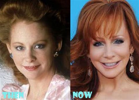 Reba McEntire Plastic Surgery Before After Pictures - Lovely Surgery ...