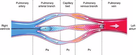 Pulmonary Capillary Wedge Pressure Pulmonary Artery Wedge Pressure | Hot Sex Picture