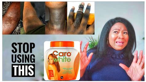 Stop Using Caro White|Caro White Bleaching Cream Side Effects ...