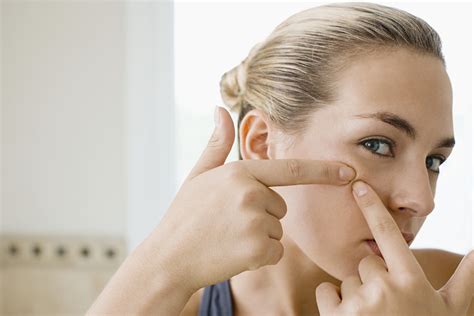 What to Do for an Infected Blackhead? | Healthfully