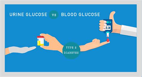 Sugar in Urine - Everything You Need to Know - Sugar.Fit