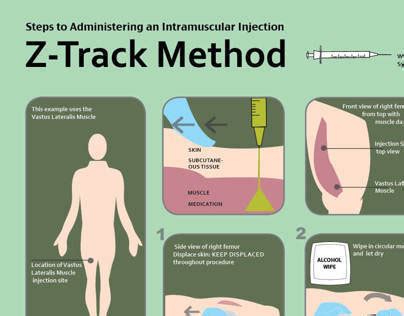 Z-Track Procedure on Behance