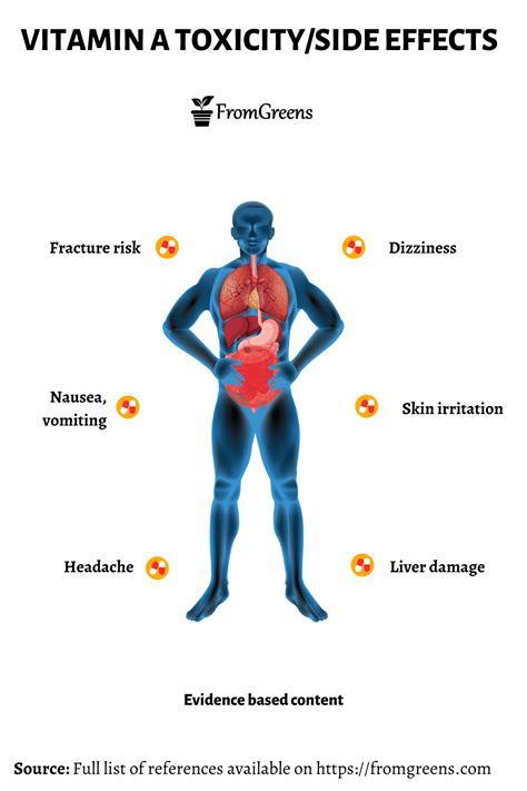 Vitamin A Toxicity Side Effects - Evidence Based Content