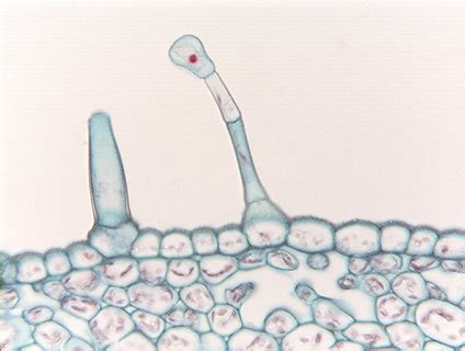 Glandular trichome