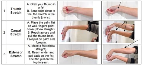 Carpal Tunnel Syndrome: 3 Great Exercises!