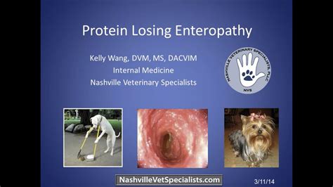 Protein Losing Enteropathy Wikipedia