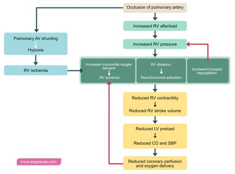 Pulmonary Embolism (PE): Causes, symptoms, diagnosis, treatment