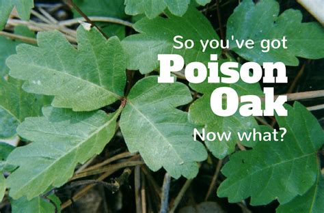 Natural remedy for poison oak | Poison oak, Natural remedies, Remedies