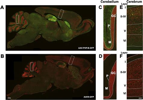 Improved systemic AAV gene therapy with a neurotrophic capsid in ...