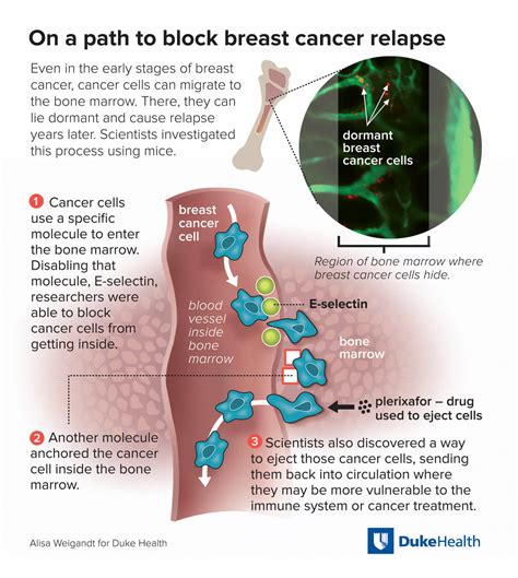 Cancer’s Spread to Bone - NCI