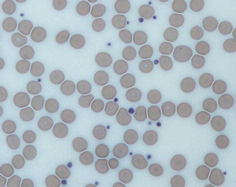 Platelets Microscope