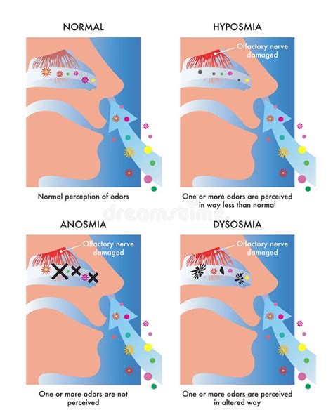 Olfactory Medical Illustrations Stock Vector - Illustration of odor, sense: 201726097