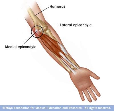 Elbow and Forearm Disorders