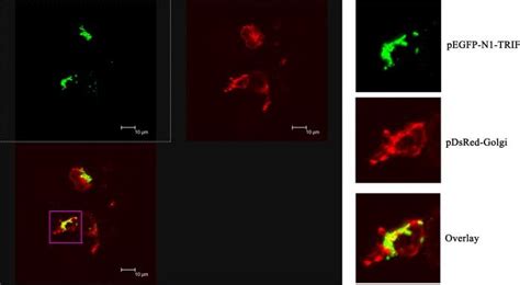 Colocalization of zebrafish TRIF with a Golgi apparatus marker gene.... | Download Scientific ...