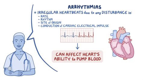 Arrhythmias - Sinus tachycardia and sinus bradycardia: Nursing ...