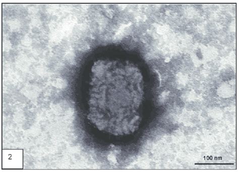 Orthopoxvirus particle, Brazilian Cantagalo strain (negative staining ...