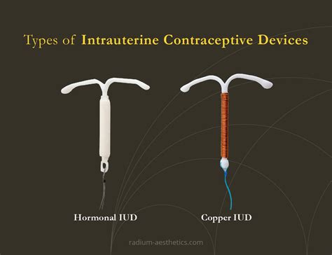 Intrauterine Contraceptive Device | Radium Medical Aesthetics