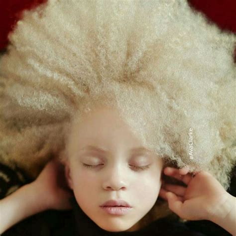 You'll Be Amazed By These Albino People And Their Unique Beauty (32 pics)