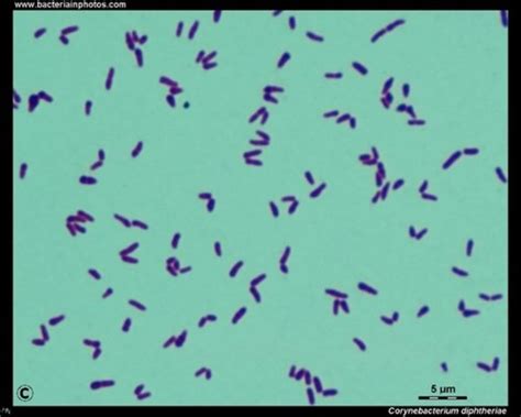 Microbiology - labs 7-14 Flashcards | Quizlet