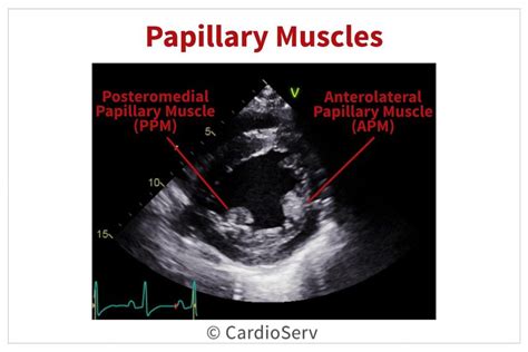 Pin on cardio