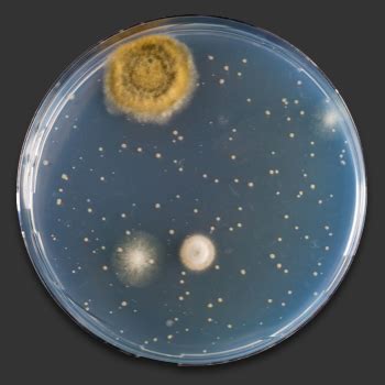 Petri Dish Bacteria Identification