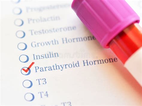 Blood Sample for Parathyroid Hormone Test Stock Image - Image of parathomone, analyzing: 157212051