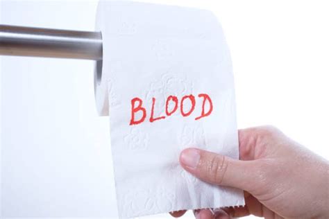 Treatment for Blood in Stool - Sydney Gut Clinic