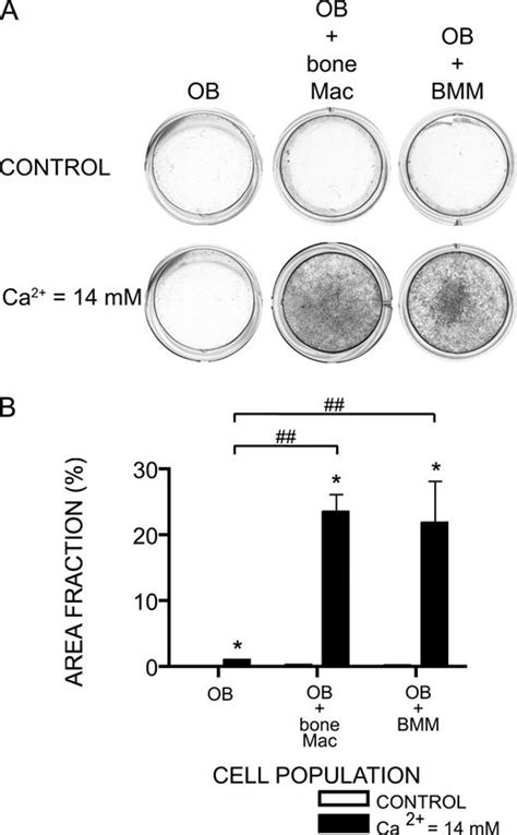 Osteal Tissue Macrophages Are Intercalated throughout Human and Mouse Bone Lining Tissues and ...