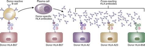 Significance of HLA-DQ in kidney transplantation: time to reevaluate ...