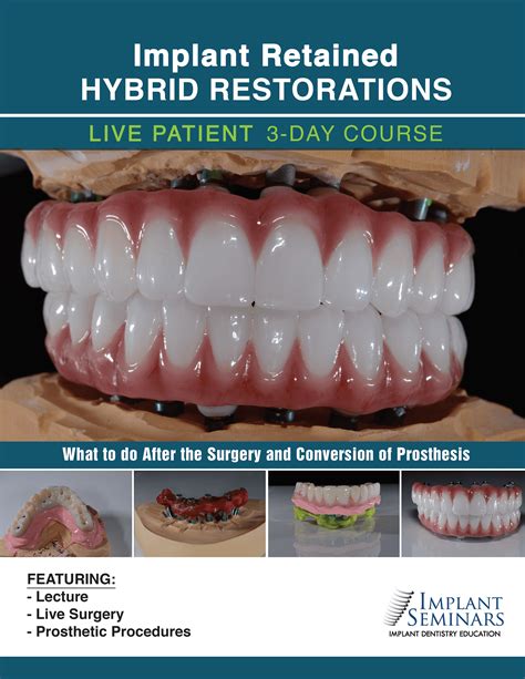 Implant Retained Hybrid Restorations