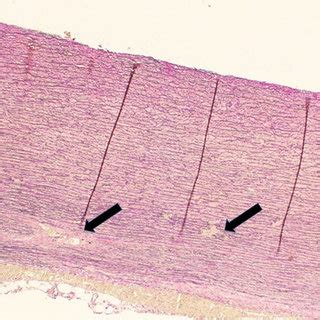 Representative histology of ascending aortic wall histology showing... | Download Scientific Diagram