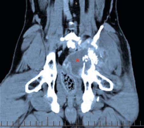 Case Study: The Role of Hemipelvectomy | Veterinary Specialists Auckland