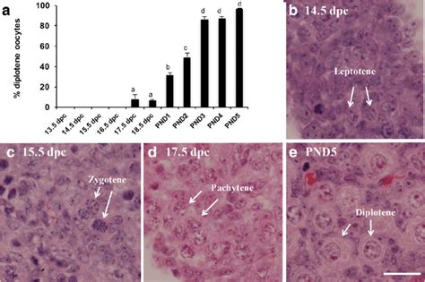 Diplotene stage oocytes are first detected at 17.5 dpc. a Percentage of... | Download Scientific ...