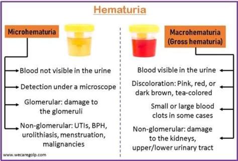 Hematuria (Blood in the Urine) - We Care