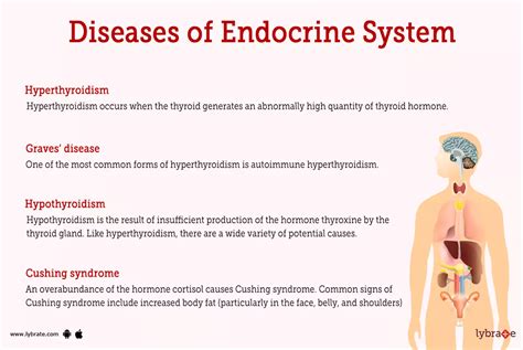 Common Symptoms And Causes Of Endocrine System Disorders - Ask The ...