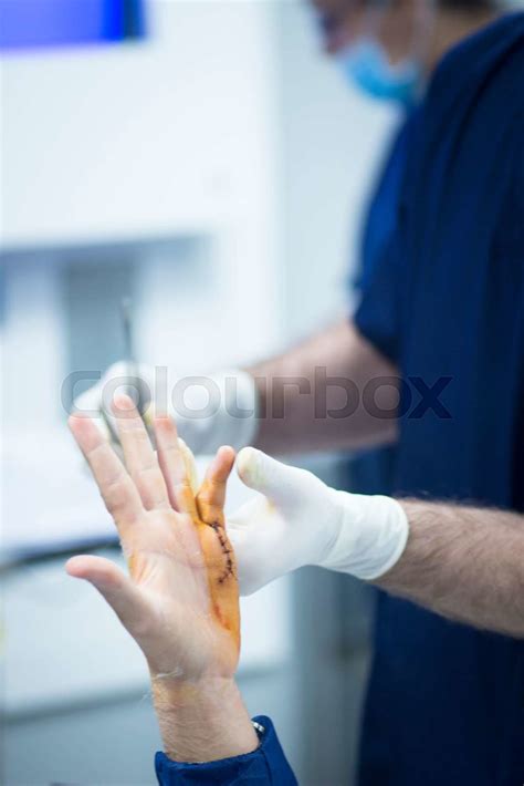 Hospital hand surgery orthopedics operation | Stock image | Colourbox