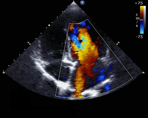 Echocardiography/Ultrasound | Valentino Cardiology Specialists