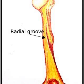 Radial groove. The posterior humerus's drawing shows a historical ...