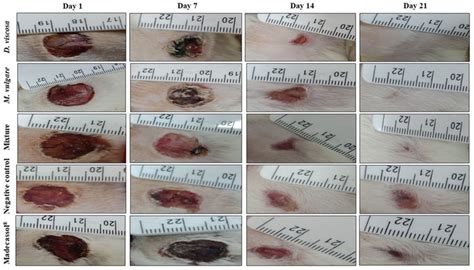 Aspect and photographical representation of burn healing process and... | Download Scientific ...