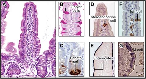 The Intestinal Crypt, A Prototype Stem Cell Compartment: Cell