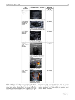 Ultrasound thyroid nodule | PDF