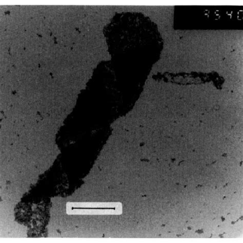 Electron micrograph image ( negative stain microscopy) of a DC,."PC... | Download Scientific Diagram