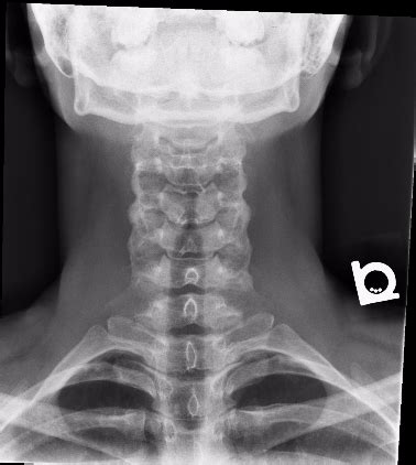 Head and Neck – Undergraduate Diagnostic Imaging Fundamentals