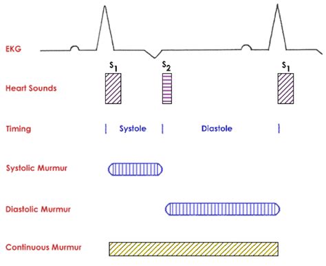 Understanding Normal and Abnormal Heart Sounds – Clinical Medicine 1 ...