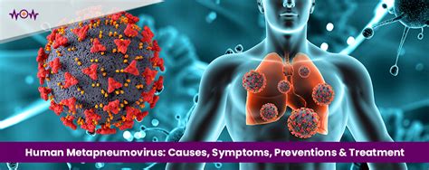 Human Metapneumovirus: Causes, Symptoms, Preventions & Treatment