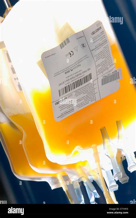 Platelet transfusion hi-res stock photography and images - Alamy