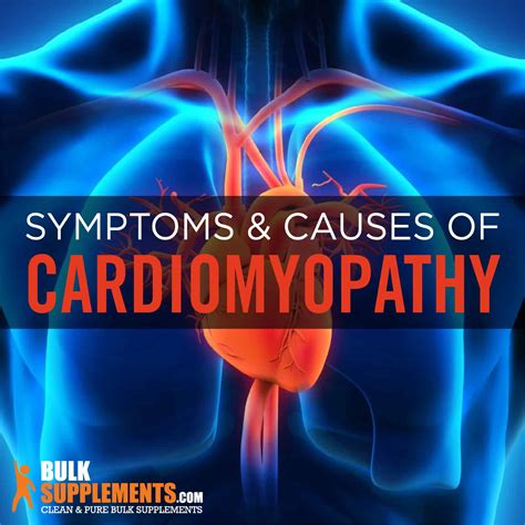 Cardiomyopathy: Symptoms, Causes & Treatment