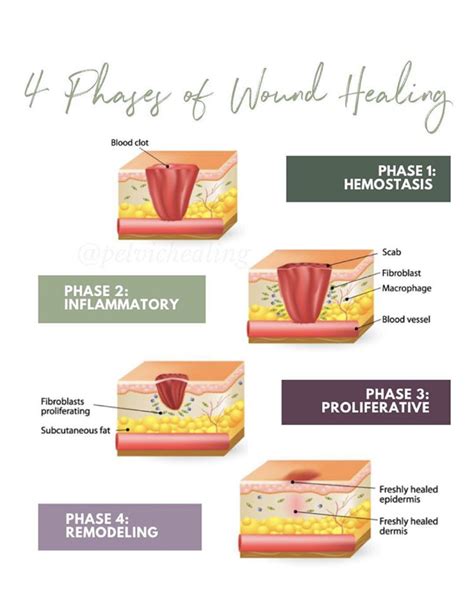 Scar Tissue and Adhesion Treatment