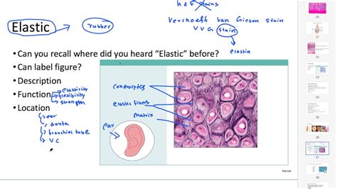 4. Elastic Cartilage (Structure, Function and Location) - YouTube