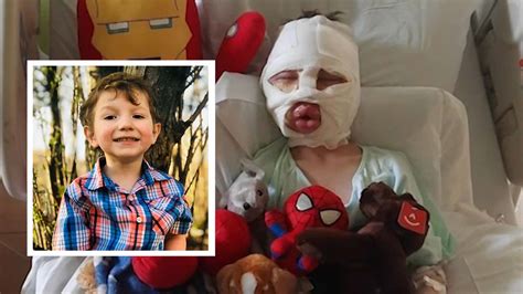 Connecticut Bully Attack: Bridgeport Boy Burned by Neighbor, Family Says – NBC New York
